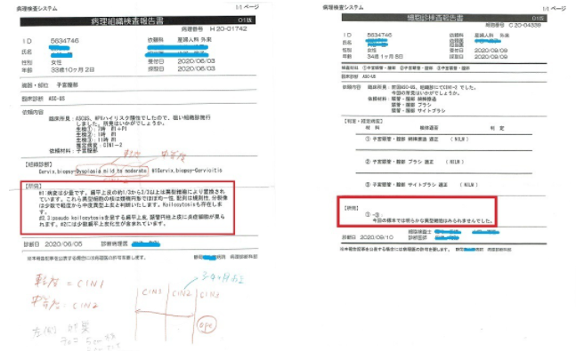 4回の体外受精失敗・卵巣チョコレート 子宮頸がん細胞検査で陽性・逆子