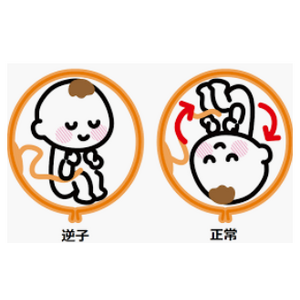 キャプチャ