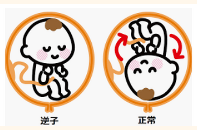 キャプチャ