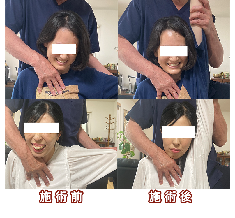 どの様にして頭部への血流が悪くなるのか？