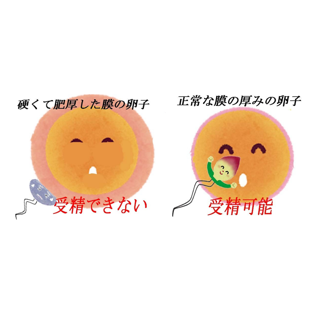 卵子の膜に脂質のコーティング